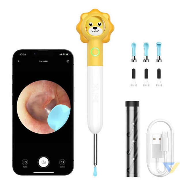 Smart Visual Ear Clean Rod Xlife Q3 (yellow) Otoscopes